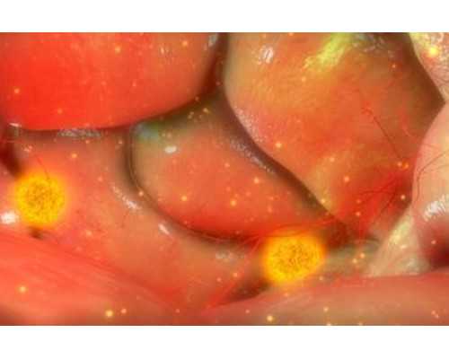 好孕代孕公司,哪些因素导致女性多囊卵巢综合征！怎么导致女性得多囊卵巢！