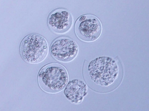
              一般怀孕几个月到生产医院建大卡比较合适？
            
