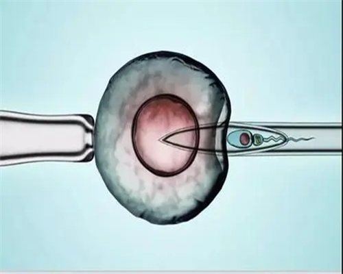 代孕包儿子,2026泰国试管婴儿攻略索引：A卵B怀，精子库供精入境难
						